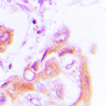 AMPK beta 1 (pS182) Antibody