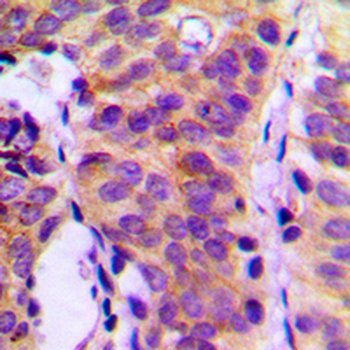 PLC gamma 1 Antibody