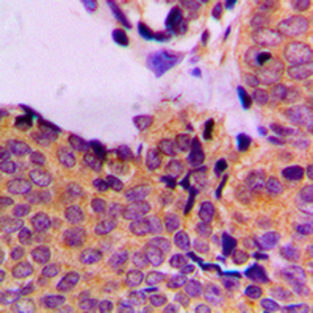 PDPK1 (pS241) Antibody