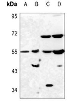 PAH Antibody