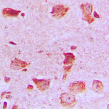 NDUFA8 Antibody