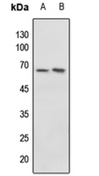 c-Myc (pT58) Antibody