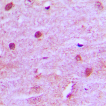 MNAT1 Antibody