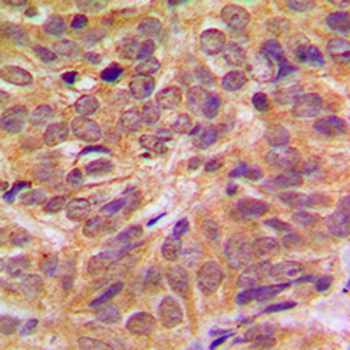 FOXO4 (pS197) Antibody