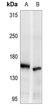 ASK1 Antibody