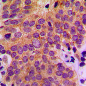 ASK1 Antibody