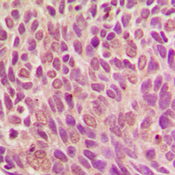 SMAD1 (pS187) Antibody