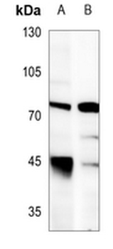 LIMK1 Antibody