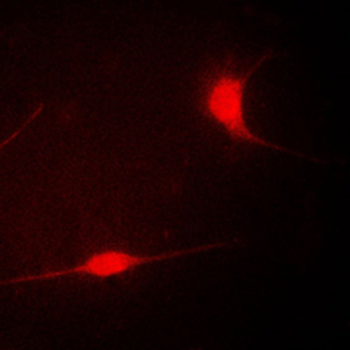 LIMK1 Antibody