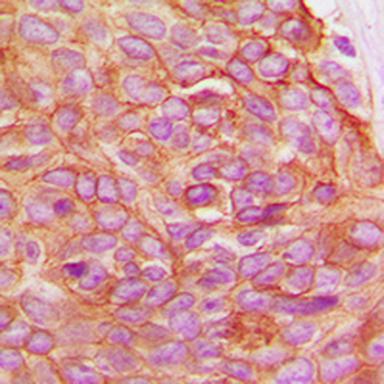 Gamma-catenin Antibody