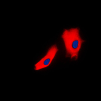 Gamma-catenin Antibody