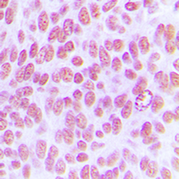 c-Jun (pY170) Antibody