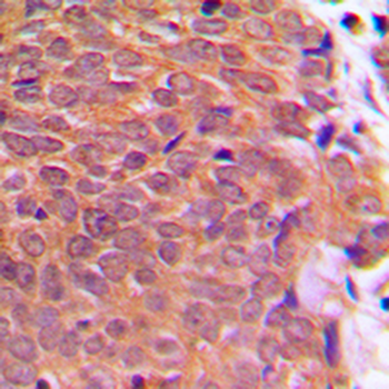 Cofilin (pS3) Antibody
