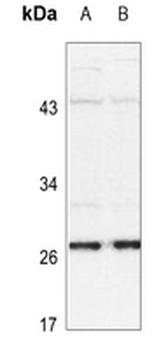 HSP27 (pS15) Antibody