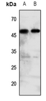 Histamine H2 Receptor Antibody