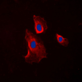 Histamine H2 Receptor Antibody