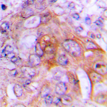 HADH2 Antibody