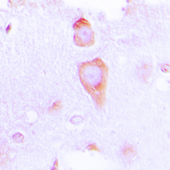 GUCY1B3 Antibody