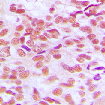 GSK3 alpha/beta Antibody