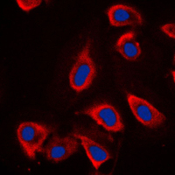 mGLUR6 Antibody