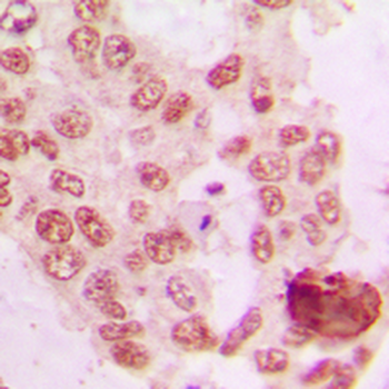 GRK5 Antibody