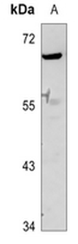 GDF9 Antibody
