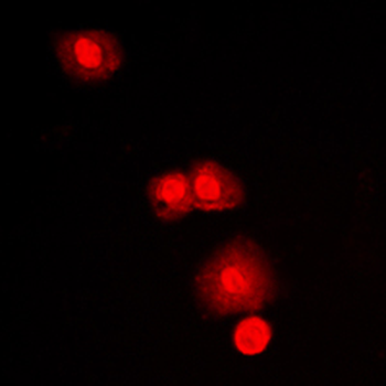 mTOR Antibody