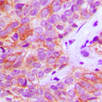 FGFR3 Antibody