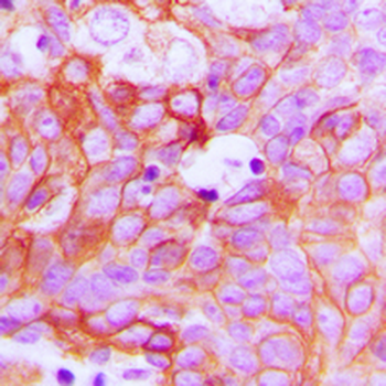 Ephrin A1 Antibody