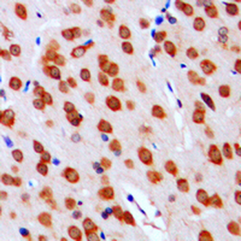DGK alpha Antibody