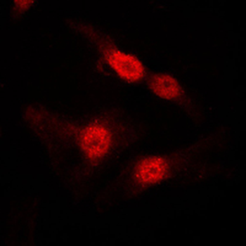 DGK alpha Antibody