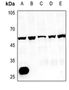 CMKLR1 Antibody