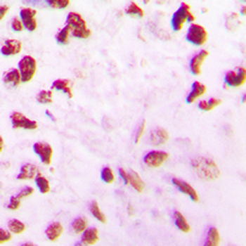 CLK2 Antibody