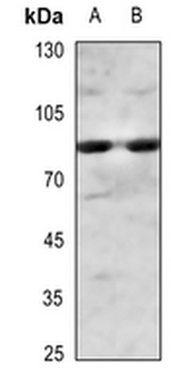 IKK alpha/beta (pS180/181) Antibody