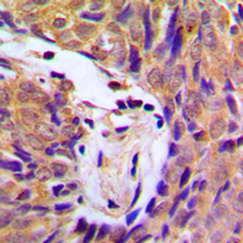 IKK alpha/beta (pS180/181) Antibody