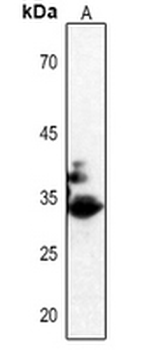 CDK2 (pT160) Antibody