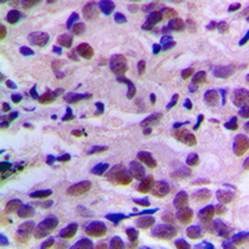 CDK2 (pT160) Antibody