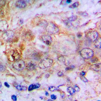 Carbonic Anhydrase 2 Antibody