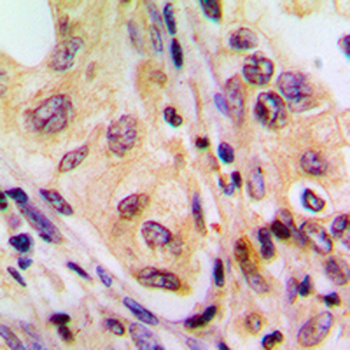 B-RAF Antibody