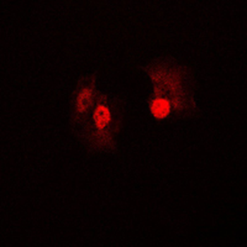 B-RAF Antibody