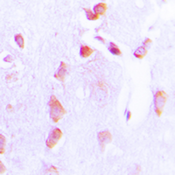 BCL2 (pT69) Antibody