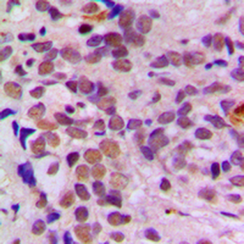 ATF1 Antibody