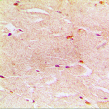 Alpha-actin-3 Antibody