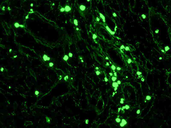 COCKTAIL (IGA+ IGG + IGM)-CF 488 Antibody