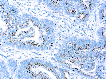 CASPASE 3/CPP32 Antibody