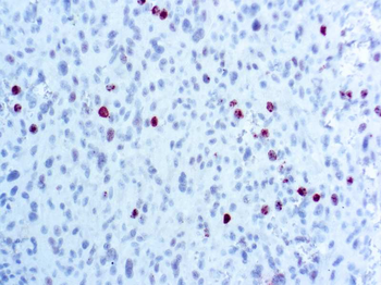 PHOSPHOHISTONE H3 (PHH3) Antibody