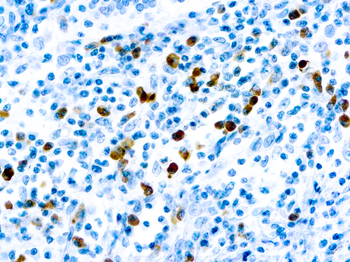 LAMBDA LIGHT CHAIN Antibody