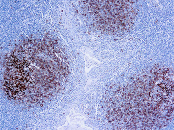 CD23 Antibody