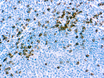 CD8 T-CELL Antibody