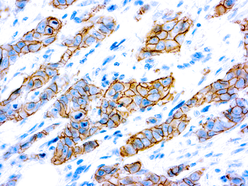 HER2/NEU (C-ERBB-2) Antibody